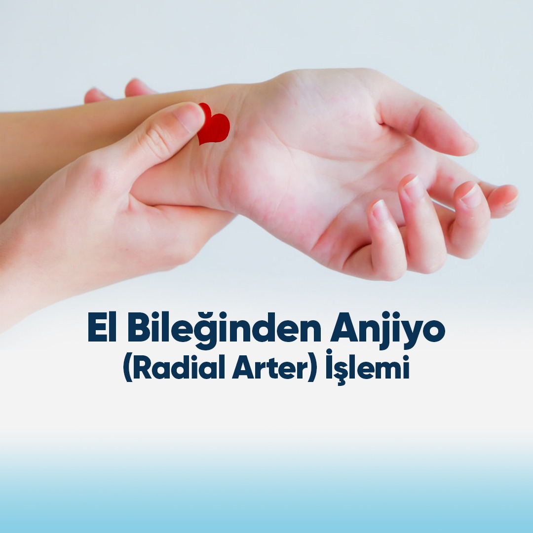 EL BİLEĞİNDEN ANJİYO (RADİYAL ANJİYOGRAFİ) İŞLEMİ