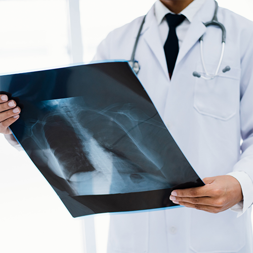 CHEST DISEASES