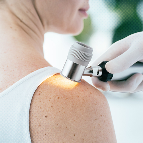 DERMATOLOJİ (CiLDiYE)